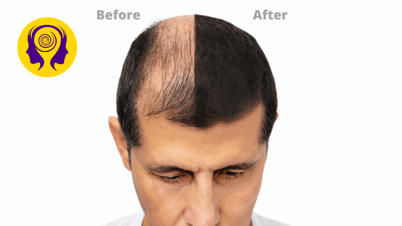 Hair Growth